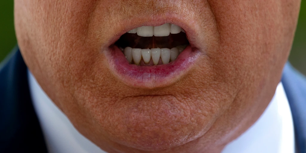 Donald Trump after dental work